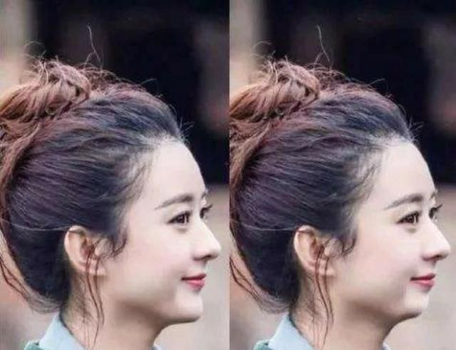 下巴丑如何解决,下巴长得丑怎么用自然方法改善