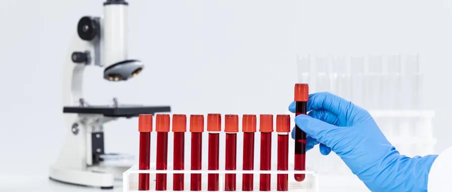 借你一双慧眼，从此看血液检查报告不再云里雾里