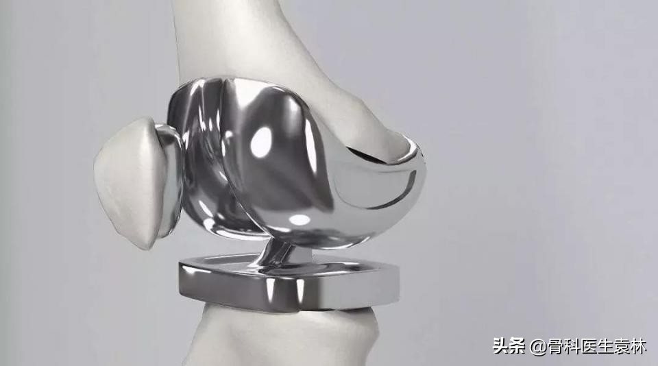 膝关节有点骨质增生怎么能治好,膝关节骨质增生怎么治效果好