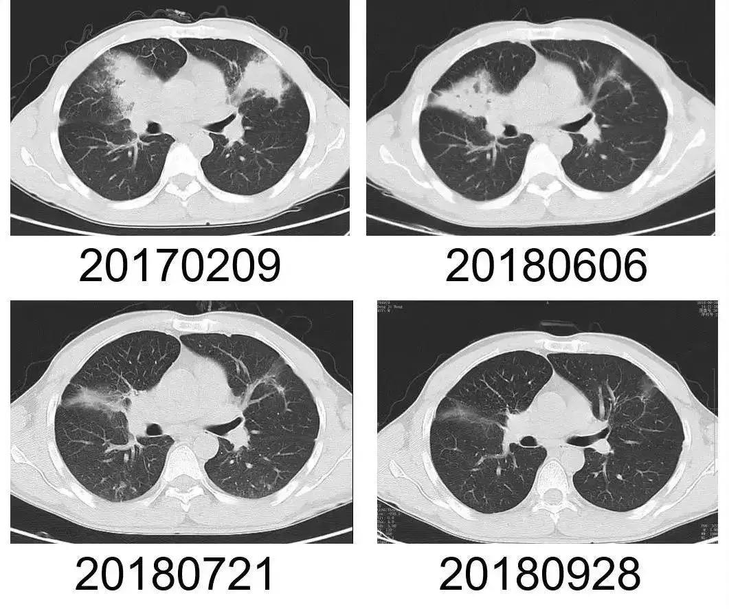 【提醒】他摸了出土*物文**，然后住院八次