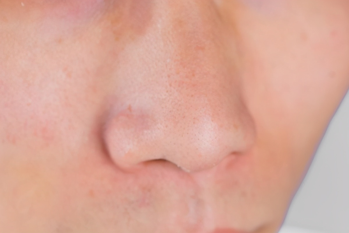 窜出来的鼻毛能剪吗,不小心把鼻毛揪下来会怎么样