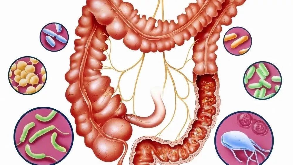 菌群问题,过敏与肠道菌群失调有关吗