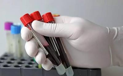 黄芪降蛋白降肌酐效果怎么样,肾功能肌酐升高是什么原因