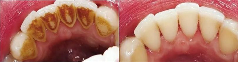 口腔专用香水,能持久留香的口腔香水