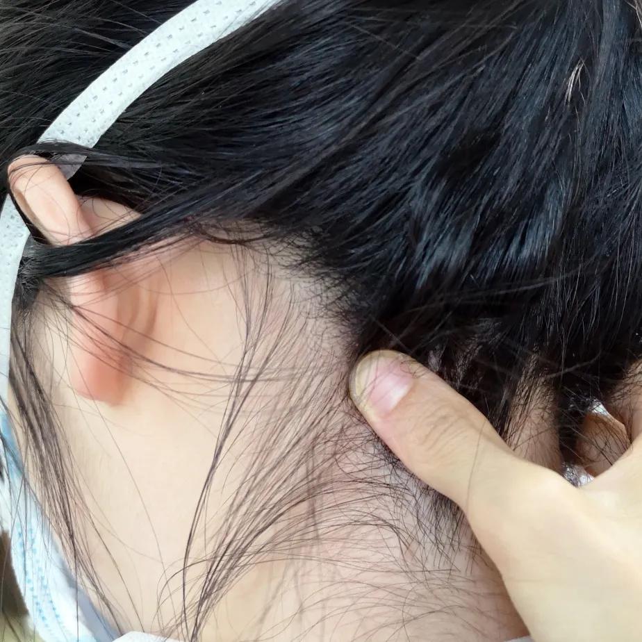 儿童过敏性鼻炎的治疗方法推拿,过敏性鼻炎咳嗽推拿哪些穴位