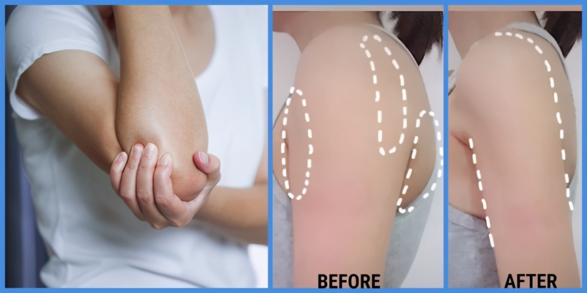 中医穴位瘦手臂,按摩式瘦手臂