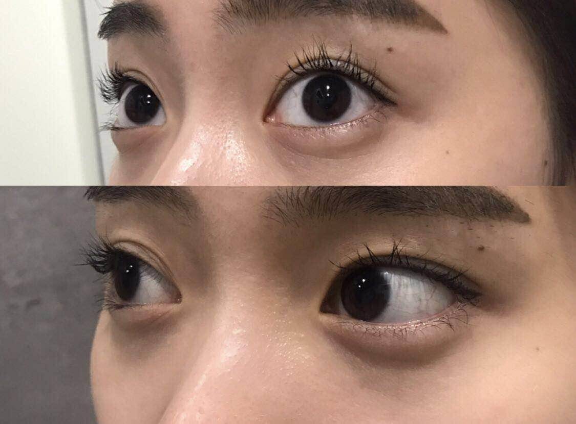 保持眼部健康的建议,眼部的状态每天都会变化吗