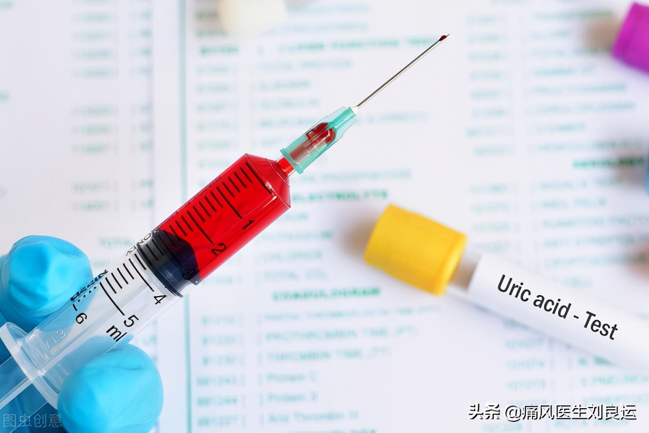 痛风患者查尿酸前能不能吃药,患了痛风到医院要做哪些检查