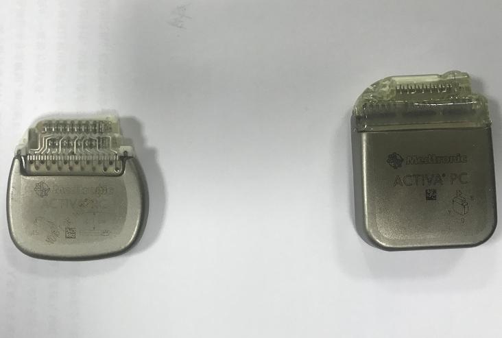 脑起搏器手术福州,帕金森病患者脑起搏器手术后效果