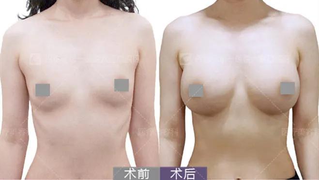 女生运动瘦不下来,女人运动瘦不下来怎么回事