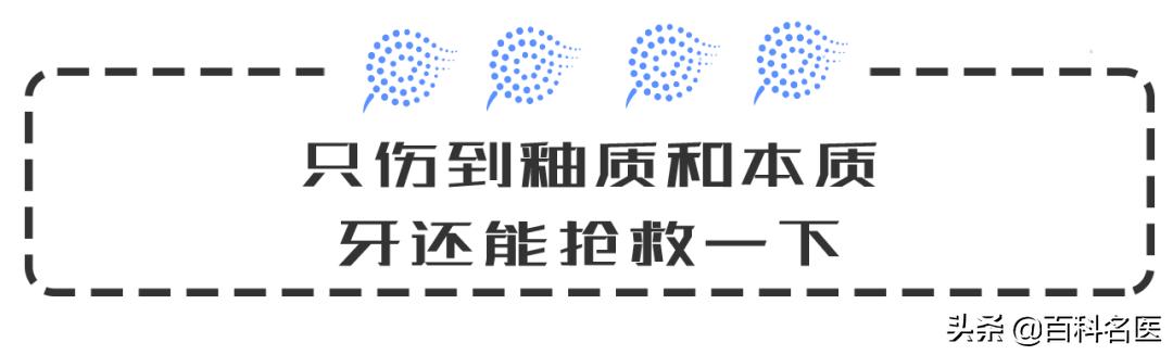 根管治疗为什么牙那么痛,烂牙做根管治疗是不是很痛
