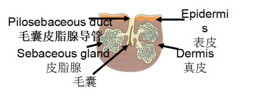 壬二酸对什么样的痘痘有效,壬二酸会让粉刺变多吗