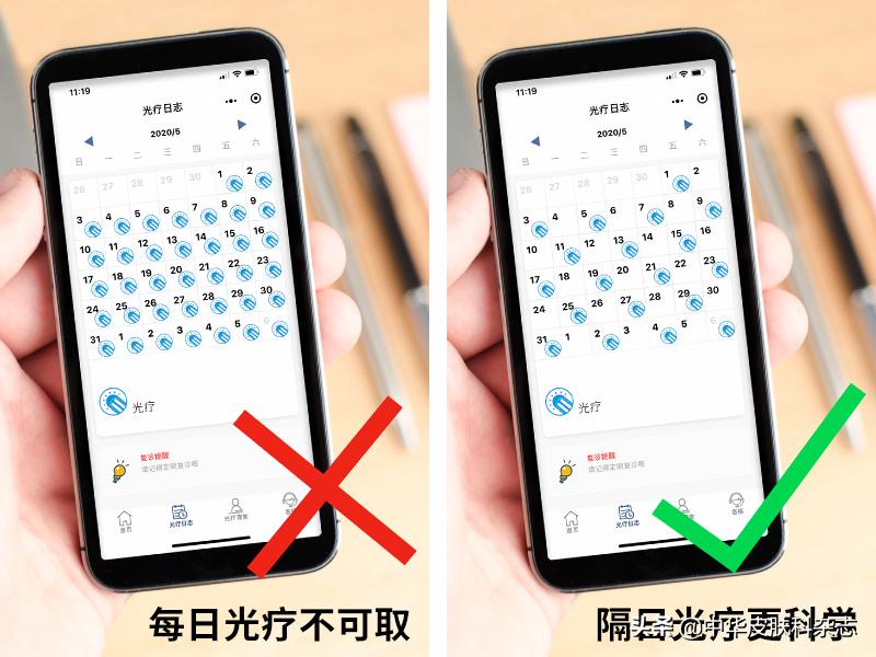 家庭光疗：简单背后有大学问