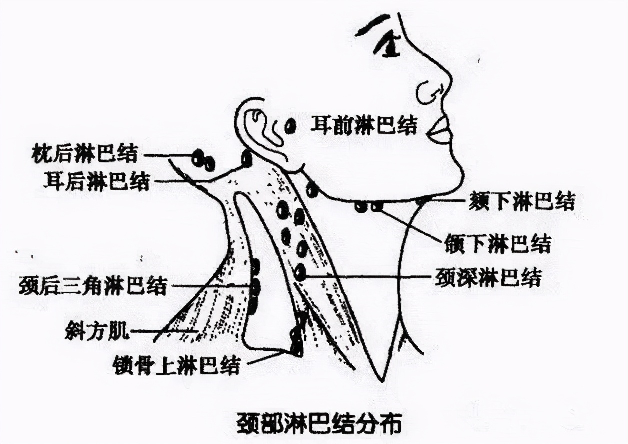 颈部里面长了个硬疙瘩,颈部长硬疙瘩挂什么科