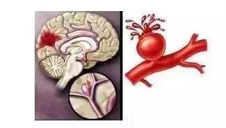 怀孕8月身患重病,怀孕8月被陷害坐牢