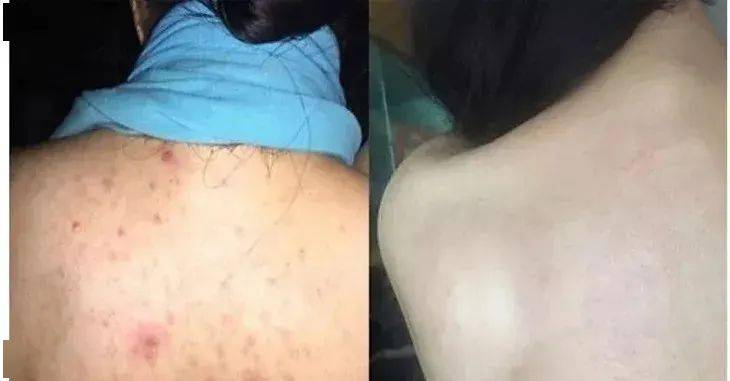 英国珀婷pertine除螨喷雾剂,瑞士珀婷pertine除螨喷雾剂