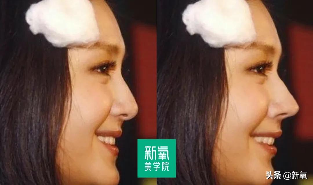 短翘鼻漂亮女星,小翘鼻适合方形脸