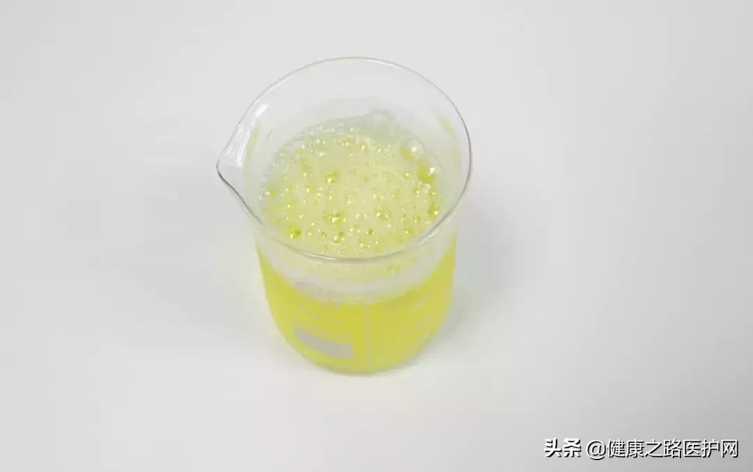 肾有问题了会小便频繁吗,肾不好是看小便次数还是尿量