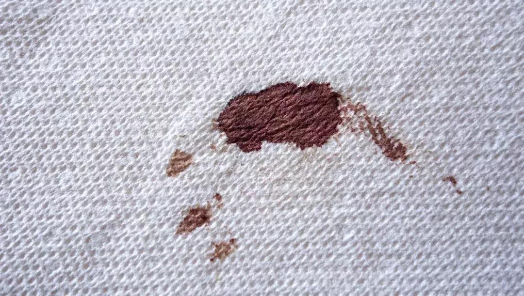 白衣服不小心染上了污渍怎么办,白衣服弄脏了怎么洗才能洗干净