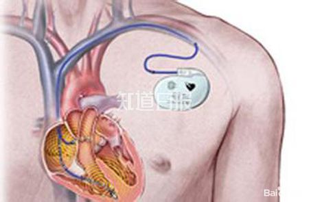 人工塑料夜明珠,人工夜明珠为什么也能发光