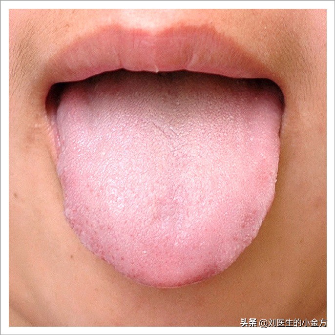 舌象图解大全中医舌诊,最全中医舌诊图谱来了