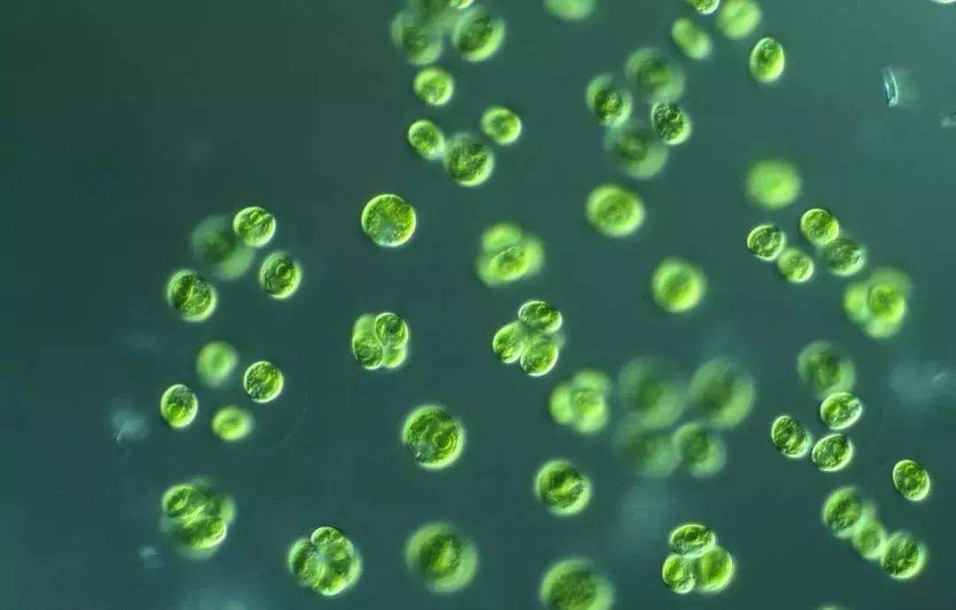 地球为什么没有微生物,如果没有微生物人类会如何