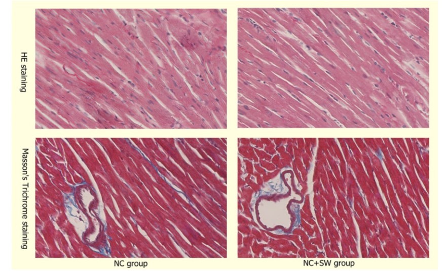 北京协和医院治心脏好吗,体外心脏震波治疗系统