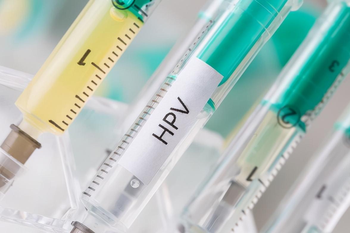 HPV是什么？HPV和宫颈癌有什么关系？HPV的感染途径有哪些？