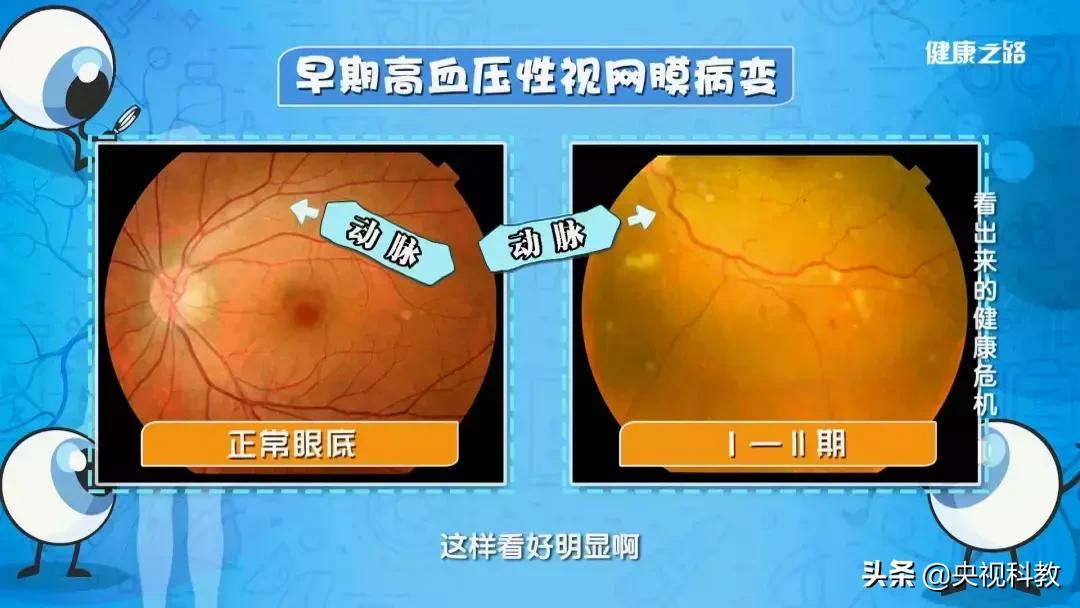 眼底照相全过程,拍一张眼睛的照片