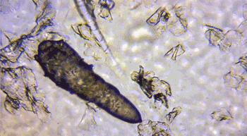 爱长痘的人一直长痘,爱长痘痘的皮肤