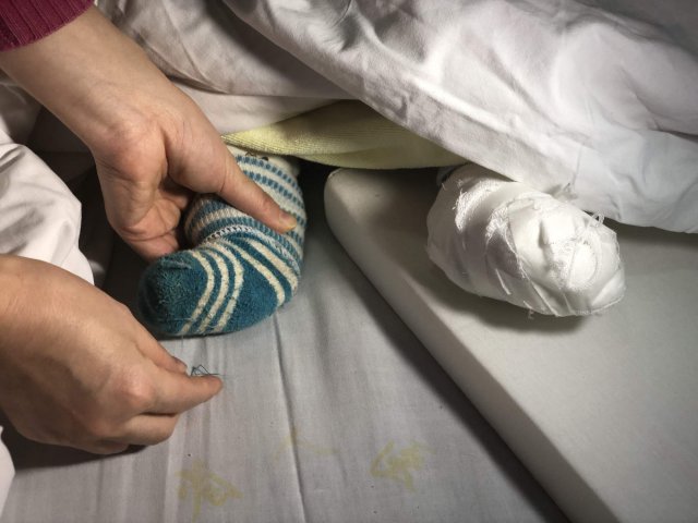 婴儿脚趾甲边上起脓泡挑破可以吗,婴儿脚趾长肉刺红肿