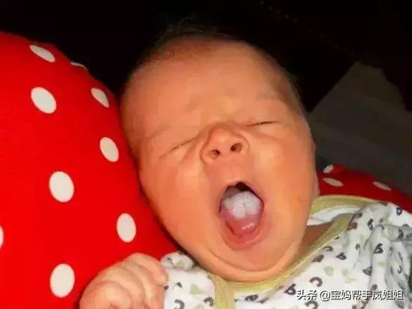 鹅口疮常见的感染菌是什么,引起鹅口疮最常见的因素有