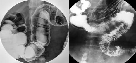 造影检查会让人痛苦吗:带你了解一下各种造影检查的操作过程