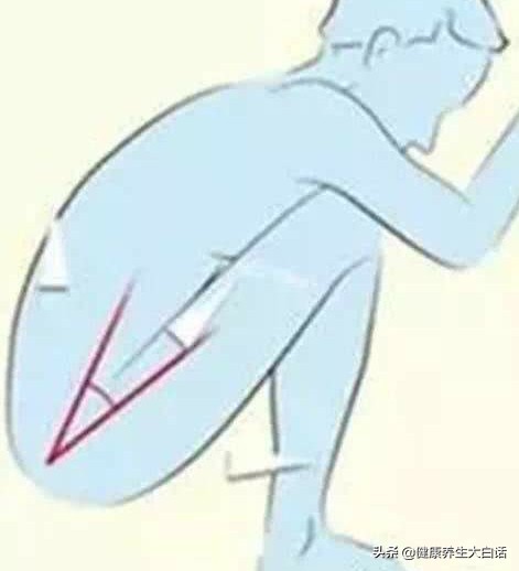 痔疮最好的治疗方法是坐浴，为什么坐浴后会加重？