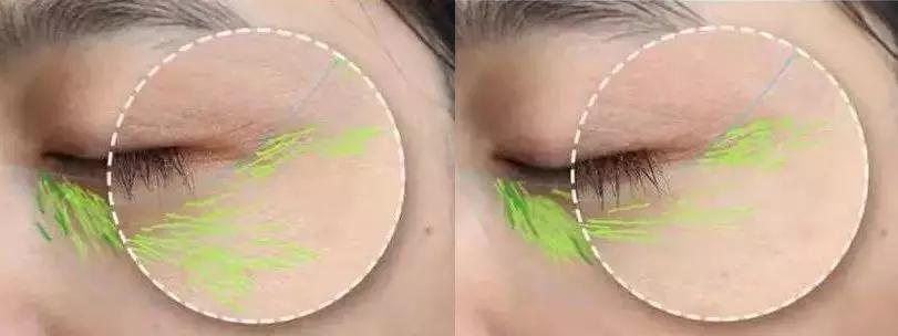 真人改造|不靠医美，一天实现“换皮”