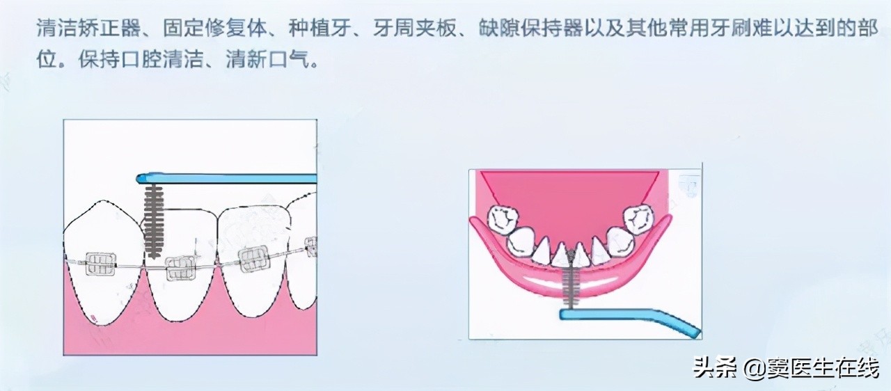用手抠牙齿手上有臭味,牙缝一抠出血有臭味