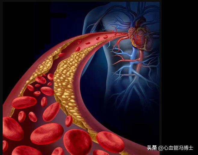 消除斑块的食物食谱,消除斑块最好的水果