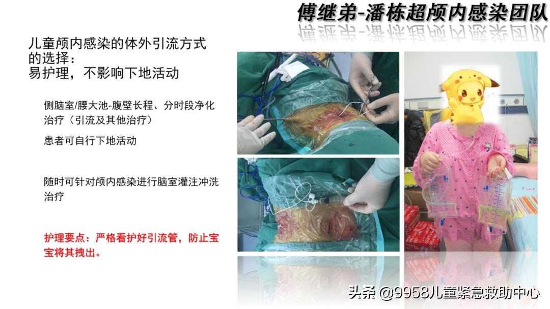 颅内感染康复治疗知识,小儿颅内感染的健康宣教