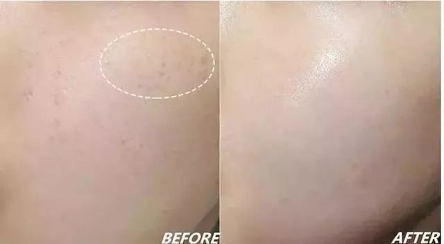 火到断货的“明星级”点斑笔，坚持每天点一下，14天养成初恋脸