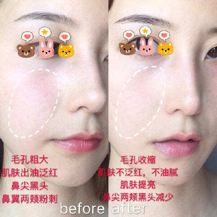 如何拯救毛孔粗大油腻的脸,毛孔粗大油皮救星