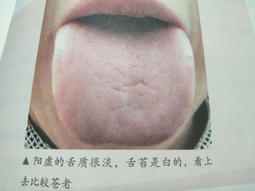 别人不冷自己却感觉冷,别人都不冷就自己冷怎么回事