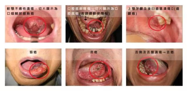 口腔常见疾病种类“大赏”，总有你经历过的