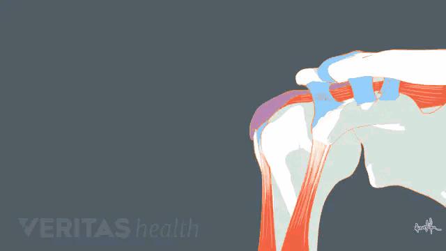肩膀痛不知什么原因,教你一个动作解决肩膀疼痛