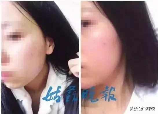 整形行业的现状,整形行业未来会淘汰吗