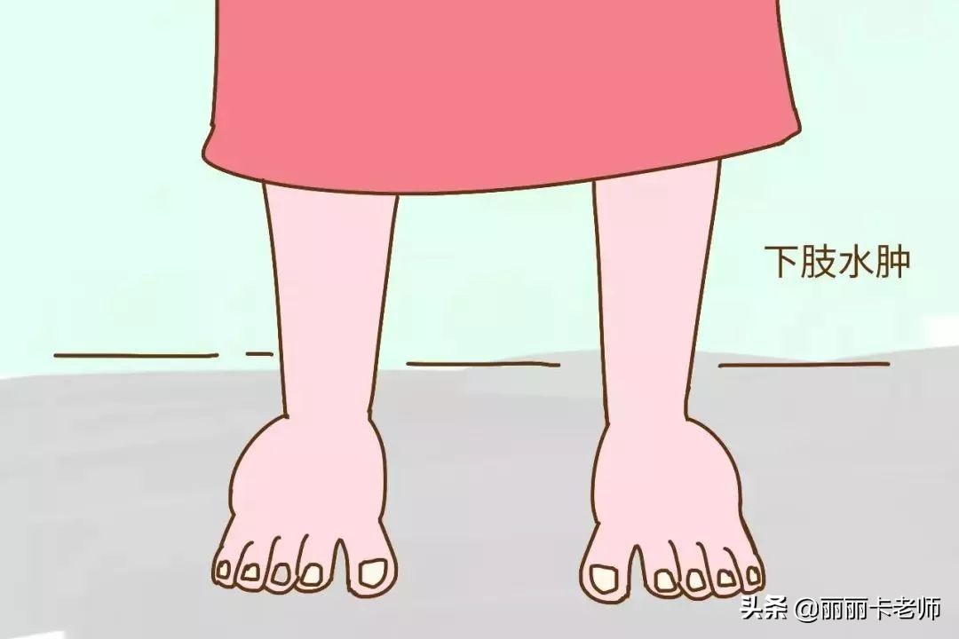 没做腋窝淋巴清扫的手臂会水肿吗,清扫淋巴腿肿能自愈吗