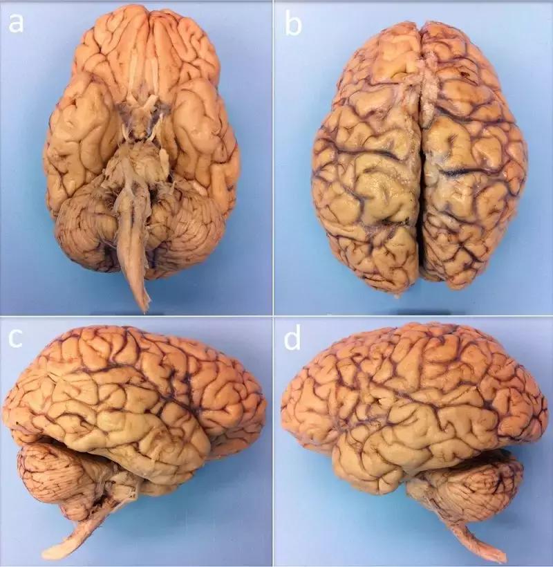 最完整人类大脑三维图像,人类大脑的结构图