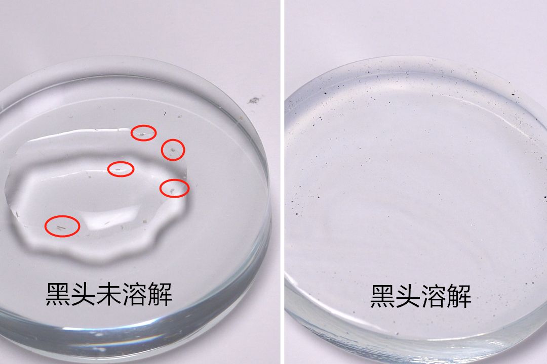 长黑头VS不长黑头差距这么大?精致女孩如何绕过黑头这道坎?