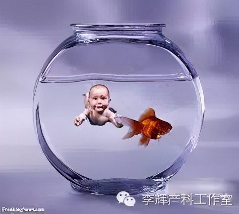 剖宫产憩室手术知情同意书,剖宫产手术同意书