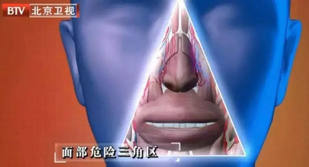 危险三角区会有什么症状,面部危险三角区有哪些危害