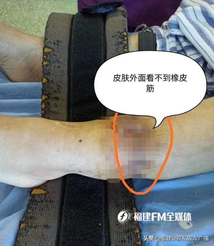 福建省级机关医院二甲,福建省级机关医院有哪些